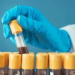 Blood Samples