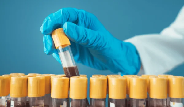 Blood Samples